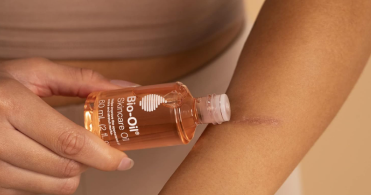 Is Bio Oil safe for pregnancy? : Glowing Through Pregnancy